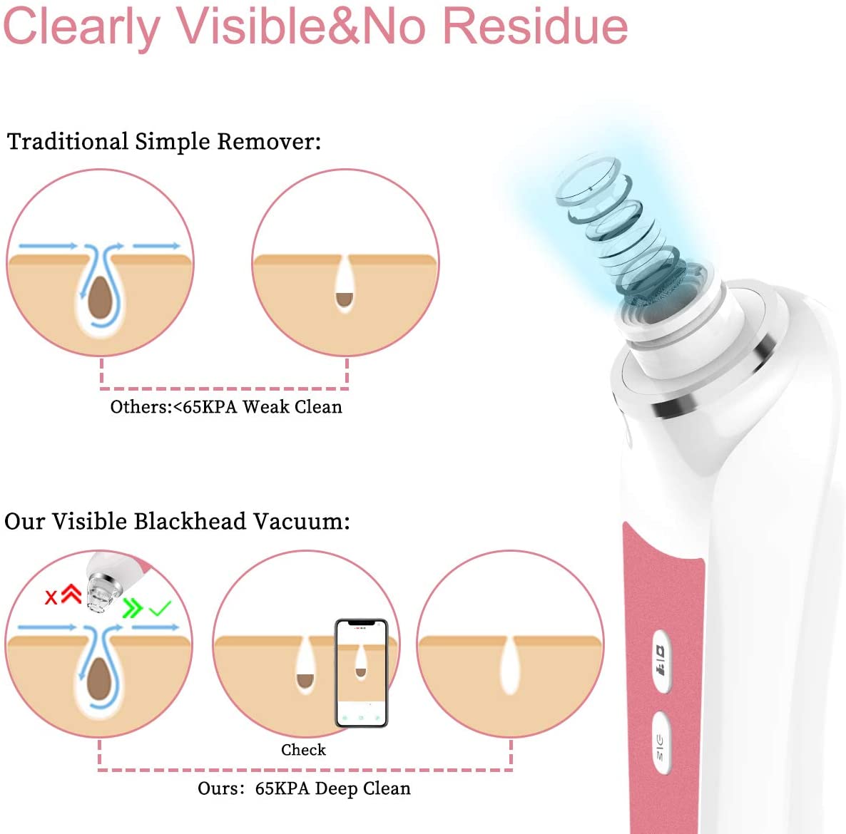 20x HD Pore Cleaner Vacuum